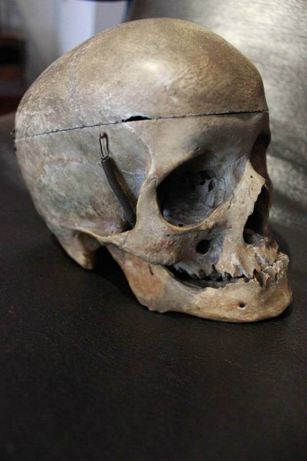 19th Century Human Skull