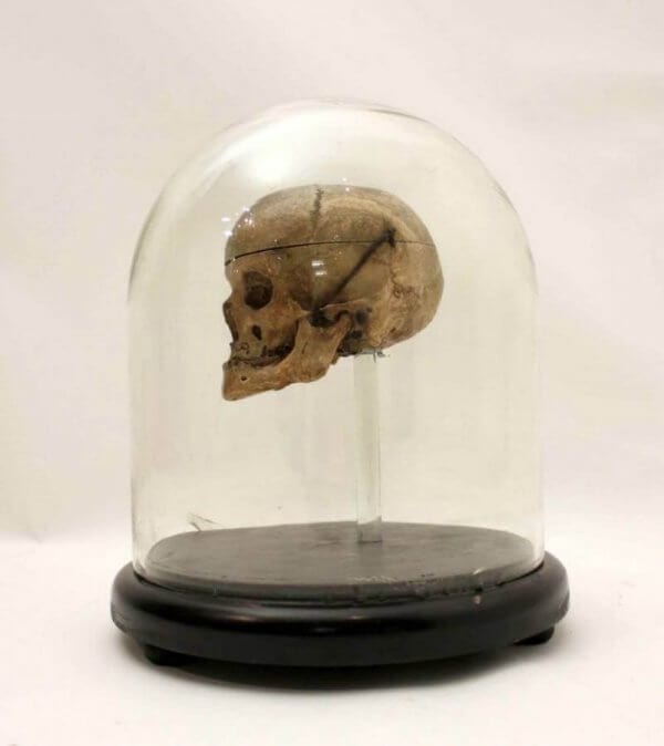 18Th Century Human Skull In A Victorian Glass Dome