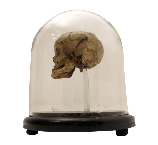 18Th Century Human Skull In A Victorian Glass Dome